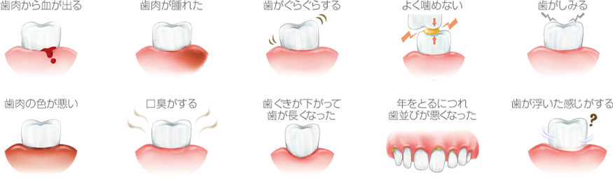 PMTC(プロフェッショナルクリーニング)